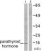 Parathyroid Hormone antibody, abx013169, Abbexa, Western Blot image 