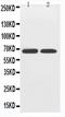 Solute carrier family 2, facilitated glucose transporter member 12 antibody, PA5-80020, Invitrogen Antibodies, Western Blot image 
