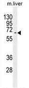 Kyphoscoliosis Peptidase antibody, AP52433PU-N, Origene, Western Blot image 