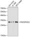 Phosphatase, Orphan 2 antibody, 14-642, ProSci, Western Blot image 