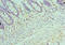 Transcription Factor Dp-1 antibody, LS-C376763, Lifespan Biosciences, Immunohistochemistry paraffin image 