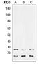 Transforming Growth Factor Beta 3 antibody, orb214663, Biorbyt, Western Blot image 