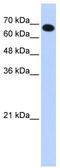 Coiled-Coil Domain Containing 38 antibody, TA337593, Origene, Western Blot image 