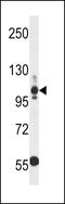 Thrombospondin 3 antibody, LS-C157189, Lifespan Biosciences, Western Blot image 