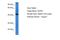 Somatostatin Receptor 3 antibody, A04188, Boster Biological Technology, Western Blot image 