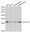 Major Histocompatibility Complex, Class II, DP Beta 1 antibody, LS-C331451, Lifespan Biosciences, Western Blot image 