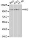 Hexokinase 2 antibody, STJ24020, St John