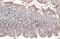 Ribonucleotide Reductase Regulatory Subunit M2 antibody, GTX636634, GeneTex, Immunohistochemistry paraffin image 