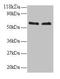 FUS RNA Binding Protein antibody, CSB-PA02704A0Rb, Cusabio, Western Blot image 
