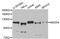 NEDD4 E3 Ubiquitin Protein Ligase antibody, MBS125743, MyBioSource, Western Blot image 
