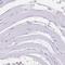 CD96 Molecule antibody, NBP2-49491, Novus Biologicals, Immunohistochemistry paraffin image 