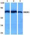 Zinc Finger Protein 875 antibody, PA5-36148, Invitrogen Antibodies, Western Blot image 
