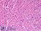 Syntaxin-18 antibody, LS-B6350, Lifespan Biosciences, Immunohistochemistry paraffin image 