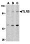 Toll Like Receptor 5 antibody, orb108986, Biorbyt, Western Blot image 