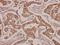 ADP/ATP translocase 3 antibody, A09457-1, Boster Biological Technology, Immunohistochemistry frozen image 