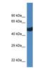 Thyroid Hormone Receptor Alpha antibody, orb333848, Biorbyt, Western Blot image 