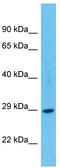 T Cell-Interacting, Activating Receptor On Myeloid Cells 1 antibody, TA332188, Origene, Western Blot image 