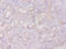 Annexin A3 antibody, A53620-100, Epigentek, Immunohistochemistry paraffin image 