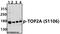 Cyclin Dependent Kinase Inhibitor 3 antibody, A05157-1, Boster Biological Technology, Western Blot image 