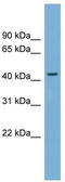 Serpin B4 antibody, TA346336, Origene, Western Blot image 