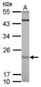 Ras Like Without CAAX 1 antibody, GTX117329, GeneTex, Western Blot image 