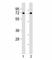 Dopamine Beta-Hydroxylase antibody, F53417-0.4ML, NSJ Bioreagents, Western Blot image 