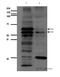 Matrix Metallopeptidase 14 antibody, ab38971, Abcam, Western Blot image 