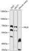 Prolactin Receptor antibody, 13-700, ProSci, Western Blot image 