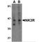 Tachykinin Receptor 3 antibody, MBS150256, MyBioSource, Western Blot image 