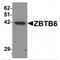 Zinc Finger And BTB Domain Containing 6 antibody, MBS151023, MyBioSource, Western Blot image 