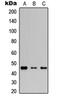 Adhesion G Protein-Coupled Receptor E2 antibody, orb256515, Biorbyt, Western Blot image 