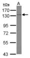 Sterol Regulatory Element Binding Transcription Factor 2 antibody, NBP2-20481, Novus Biologicals, Western Blot image 