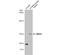 MutS Homolog 3 antibody, NBP2-19417, Novus Biologicals, Western Blot image 