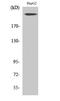 Neurofibromin 1 antibody, A00043, Boster Biological Technology, Western Blot image 