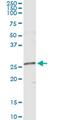 Nucleoside diphosphate kinase homolog 5 antibody, MA5-20379, Invitrogen Antibodies, Immunoprecipitation image 