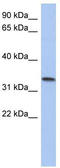 Coiled-Coil Domain Containing 172 antibody, TA333360, Origene, Western Blot image 