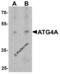 Autophagy Related 4A Cysteine Peptidase antibody, 8071, ProSci, Western Blot image 