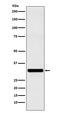 Ras-related protein Rab-27A antibody, M01608-2, Boster Biological Technology, Western Blot image 