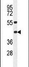 Major Histocompatibility Complex, Class I, B antibody, PA5-25020, Invitrogen Antibodies, Western Blot image 