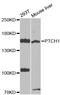 Patched 1 antibody, STJ111033, St John