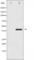 Mitogen-Activated Protein Kinase Kinase 3 antibody, abx011747, Abbexa, Western Blot image 