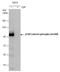 Catenin Delta 1 antibody, GTX130428, GeneTex, Western Blot image 