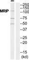 Receptor Interacting Serine/Threonine Kinase 3 antibody, PA5-39602, Invitrogen Antibodies, Western Blot image 