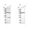 Acyl-CoA Dehydrogenase Family Member 9 antibody, NBP2-56718, Novus Biologicals, Western Blot image 