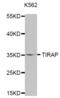 TIR Domain Containing Adaptor Protein antibody, abx001586, Abbexa, Western Blot image 