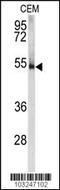 Protein Kinase CAMP-Dependent Type I Regulatory Subunit Alpha antibody, MBS9209445, MyBioSource, Western Blot image 