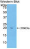 Keratin 81 antibody, LS-C315047, Lifespan Biosciences, Western Blot image 