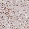 Death-inducer obliterator 1 antibody, HPA049904, Atlas Antibodies, Immunohistochemistry paraffin image 