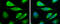 Ceramide Synthase 2 antibody, GTX130744, GeneTex, Immunofluorescence image 
