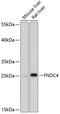 Fibronectin Type III Domain Containing 4 antibody, GTX66311, GeneTex, Western Blot image 